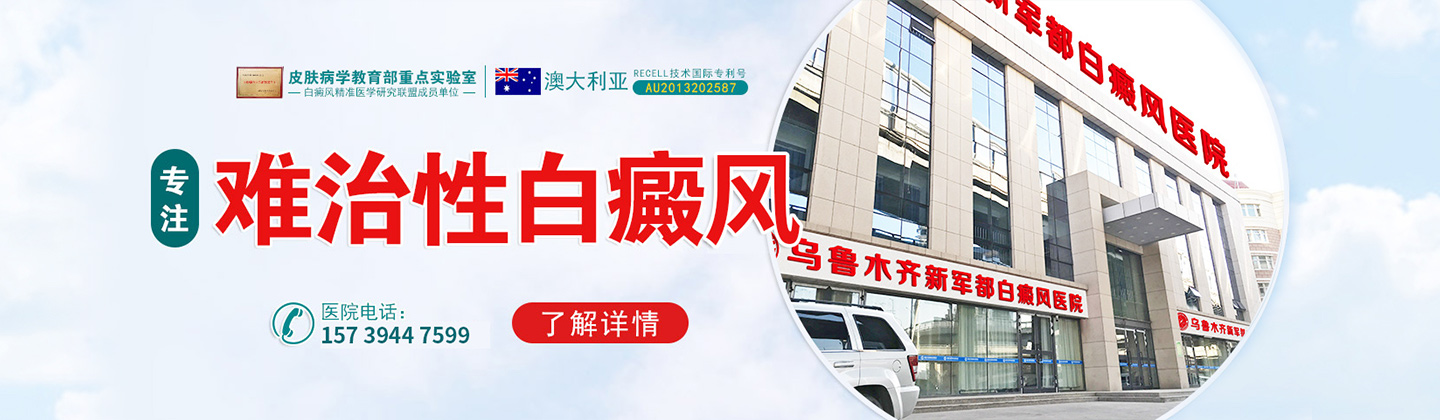 乌鲁木齐白癜风医院