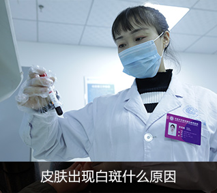 白癜风病因