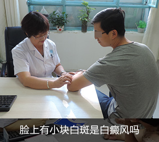 白癜风治疗