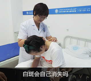 白癜风人群